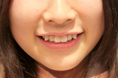 Japan’s Latest Beauty Trend: Paying Money To “Ruin” Your Teeth Cheek Piercings, Black Teeth, Crooked Teeth, Japanese Cosmetics, Photographie Portrait Inspiration, You Are Cute, Beauty Standards, Cosmetic Dentistry, Glass Skin