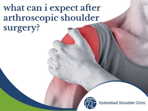 Tips To Speed Your Recovery From Rotator Cuff Surgery - hscnew Shoulder Surgery Clothes Rotator Cuff, Post Shoulder Surgery Tips, Shoulder Surgery Recovery Tips, Rotator Cuff Surgery Recovery Tips, Rotator Cuff Surgery Recovery, Shoulder Surgery Clothes, Arthroscopic Shoulder Surgery, Surgery Prep, Shoulder Surgery Recovery