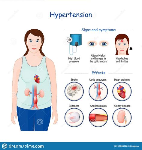 Hypertension Symptoms Signs, Hypertension Poster, Salt Logo, Nurse Study, Illustration Infographic, Brain Surgeon, Cardiovascular Disorders, Nurse Study Notes, Natural Face Cleanser