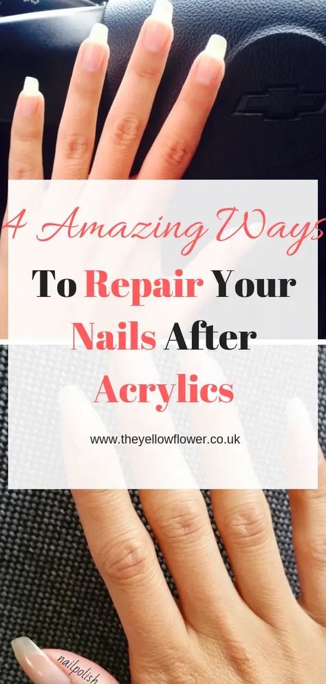 5 Amazing Ways To Repair Your Nails After Acrylics-The Yellow Flower Eyeshadow Diy, Nails Dots, Take Off Acrylic Nails, Coquette Diy, Nails Coquette, Nails Charms, Nails After Acrylics, Nails Brush, Split Nails