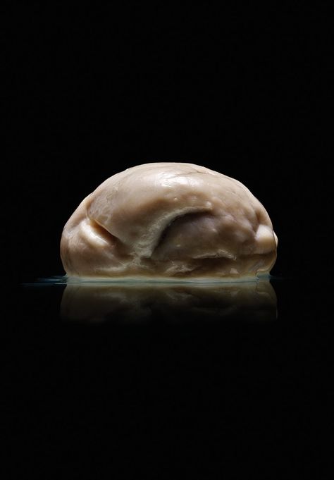 This brain belonged to a patient suffering from lissencephaly, which causes smooth surfaces rather than folds on portions of the brain. A perfectly smooth brain such as this is extremely rare. Smooth Brain, University Of Texas, The Brain, 3d Printing, Brain, Editorial, Texas, University, Tattoos