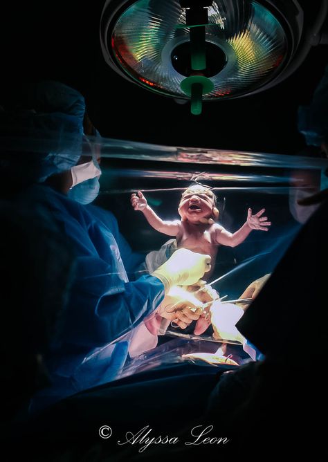 These clear plastic drapes give parents a front row seat during their C-sections. Caesarean Section Photography, Cesarean Section Photography, C Section Pictures, C Section Photography, Child Birth Photography, Baby Hospital Pictures, Birth Pictures, Medical Photography, Hospital Pictures