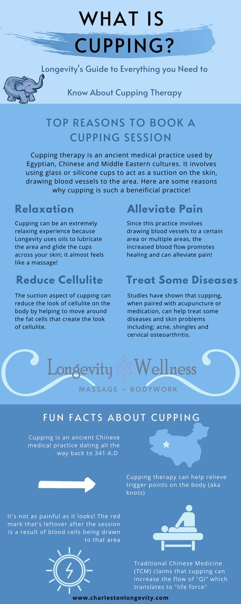 Massage & Skincare Blog— Longevity Wellness-What is Cupping and What Does it do for Your Body? Cupping Placement Chart, Wet Cupping, Home Infrared Sauna, Swedish Massage, Cupping Therapy, Skincare Blog, Medical Practice, Chemical Peel, Deep Tissue Massage