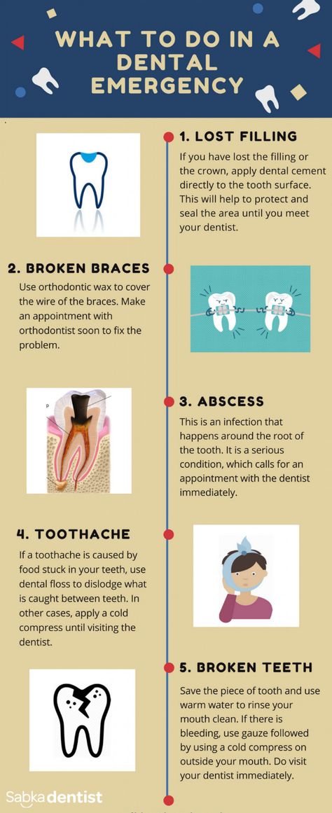 Taking care of dental emergencies at home Teeth Study, Dental Assistant Study, Broken Teeth, Tooth Infection, Dental Posts, Dental Posters, Dental Fun, Dental Cavities, Dental Emergency