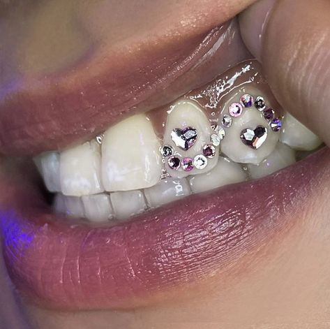 Tooth Gems On Small Teeth, Tooth Gems Ideas Cross, Tooth Gems Ideas Heart, Heart Teeth Gem, Colored Tooth Gems, Window Tooth Gem, Colorful Tooth Gems, Disco Ball Tooth Gem, Unique Tooth Gems