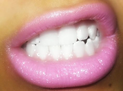 Pink Lipstick, Beautiful Lips, White Teeth, Pretty Makeup, Pink Lips, Lipstick Colors, Teeth Whitening, Trendy Nails, Lip Liner