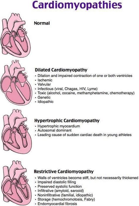 Cardiomyopathies Cardiac Sonography, Cardiology Nursing, Nursing Cheat, Nursing Mnemonics, Medical Student Study, Cardiac Nursing, Nursing School Survival, Critical Care Nursing, Nursing School Studying