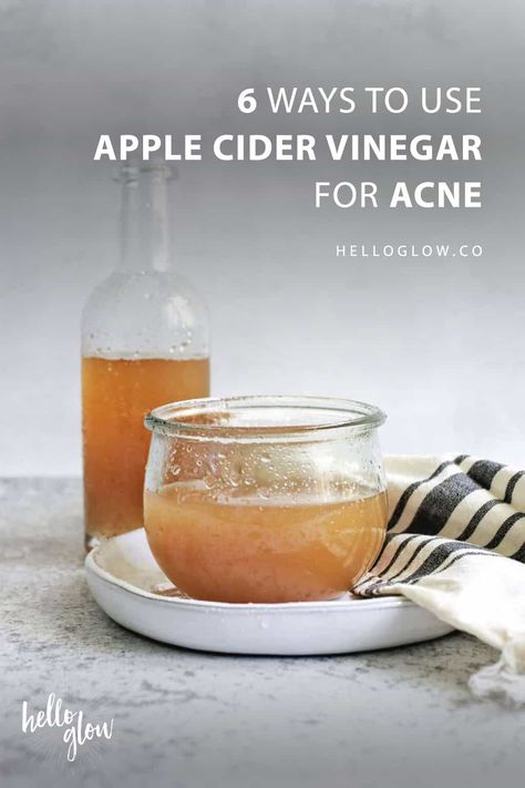 6 Ways to Use Apple Cider Vinegar for Acne Apple Cider Vinegar For Acne, Skin Care Routine For 20s, Hello Glow, Cold Sores Remedies, Natural Sleep Remedies, Natural Health Care, Baking Soda Shampoo, Natural Cold Remedies, Cold Home Remedies