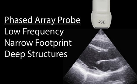 I will go over the most common Ultrasound Knobology (knobs/buttons), Probes, Modes, Movements, Orientations, and Planes you will need to properly scan. By learning these ultrasound basics, you will be able to have the fundamentals on how to use any ultrasound machine you may encounter! This post mainly goes over ultrasound machine settings, probes, buttons, and functions. Diagnostic Medical Sonography Student, Sonography Student, Medical Sonography, Ultrasound Machine, Diagnostic Medical Sonography, Ultrasound, The Basics, How To Use, Medical