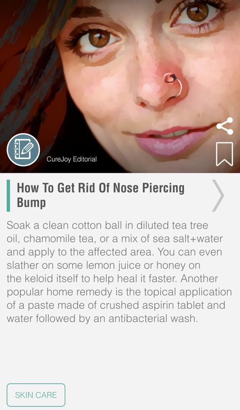 Nose Piercing Bump, Piercing Bump, Cute Ear Piercings, Nose Piercings, Turmeric Benefits, Side Eye, Chamomile Tea, Cotton Ball, Kids Nutrition