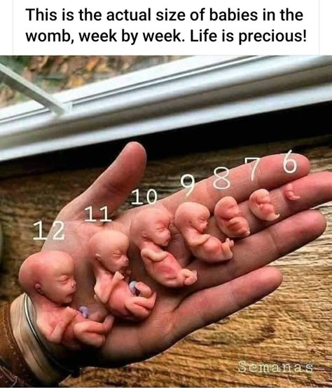 Respect Life, Baby Life Hacks, Life Is Precious, Baby Facts, Baby Advice, Baby Life, Baby Hacks, Future Baby, Baby Care