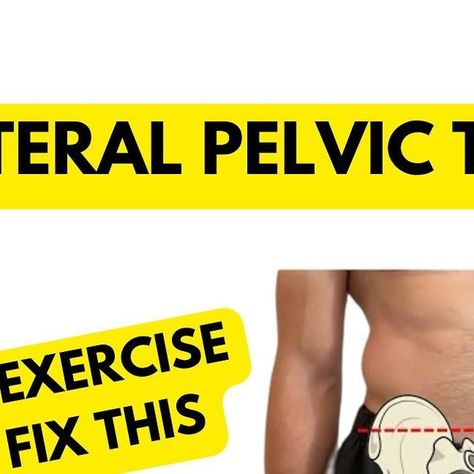 Conor Harris on Instagram: "My all-time favorite exercise for lateral pelvic tilt! If you want a deeper dive on this, I have a very extensive and thorough YouTube video named “The Best Guide on the Internet For Fixing Lateral Pelvic Tilt”. Thanks to @applied_integration_academy for this exercise! ——— #posture #posturecorrection #postureexercises #posturecorrector #lowbackpain #backpain #backpainrelief #lowbackpainexercises #backpaintips" Lateral Pelvic Tilt, Exercise Posture, Ms Exercises, Pelvic Tilt, Posture Exercises, Posture Corrector, Posture Correction, January 12, Low Back Pain