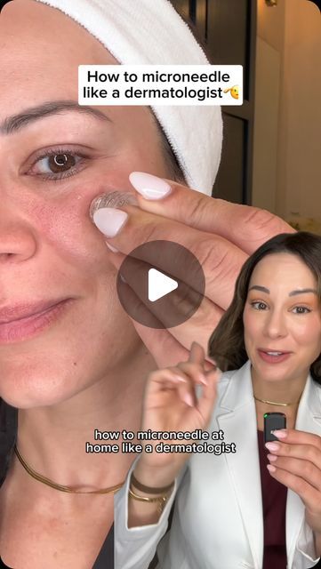 Lindsey Zubritsky, MD, FAAD on Instagram: "Comment MICRONEEDLING and I’ll DM ya a link to products to help save your skin | #QurePartner

In-office microneedling is the gold standard, but if you don’t have the time/energy/money for a trip to your derm’s office, there are ways to SAFELY do it at home. First, avoid anything that you reuse and instead choose single-use devices like this one from @qureskincare 

Next, avoid dermarollers (these causes unnecessary trauma to the skin) and opt for slow, deliberate stamping.

Questions on microneedling? Drop them below. And you can use my code DERMGURU for 10% off (save yaself some cash!) #microinfusion #microneedling" Microneedling At Home, At Home Microneedling, Rf Microneedling Benefits, Dr Pen Microneedling, Post Microneedling Care, Rejuvapen Microneedling, Microneedle Derma Roller, Derma Roller, Save Yourself