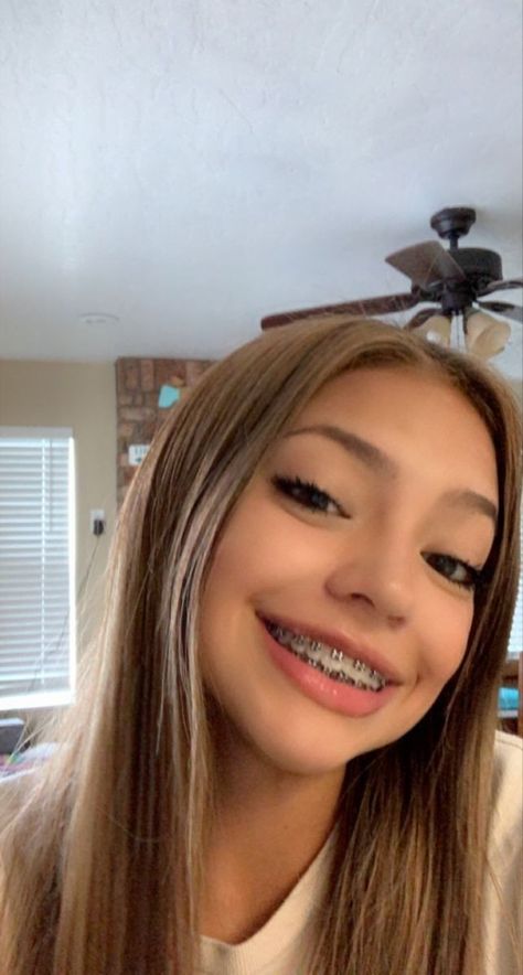 Cute People With Braces, Blonde With Braces, Pretty Girls With Braces Blonde Hair, Pretty Mexican Girls With Braces, Braces Aesthetic Girl, Latina With Braces, Baddies With Braces, Braces Selfie, Pretty Braces