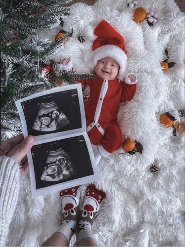 6 Weeks Old Baby, Holiday Baby Pictures, Baby Christmas Photoshoot, Christmas Baby Photoshoot, Newborn Christmas Pictures, Vom Avea Un Copil, Baby Christmas Photography, Photo Bb, Christmas Baby Pictures