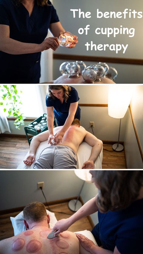 Cupping therapy in Greenville Capsules Wardrobe, Benefits Of Cupping, Face Palm, After Care, Cupping Therapy, Greenville South Carolina, Gua Sha, Blood Flow, South Carolina