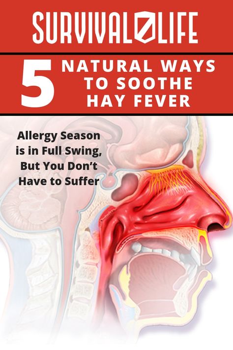 5 Natural Ways to Soothe Hay Fever | Survival Life Hay Fever Remedies, Viral Fever Remedies Home, How To Heal Cold Sores Fast, Herbal Remedies For Cold Sores, Fever Rash, Hayfever Remedies, Remedies For Allergies, Healthy Cleaning Products, Hay Fever Symptoms