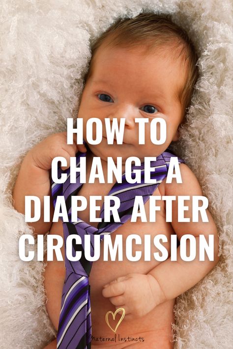 Circumcision for Newborn Boys - How to change a diaper after circumcision via @maternal_instincts Post Circumcision Care, Baby Circumcision Care, Newborn Circumcision Care, Circumcision Care Newborn, Newborn Advice, Gassy Baby, Taking Care Of Baby, Baby Information, Baby Potty