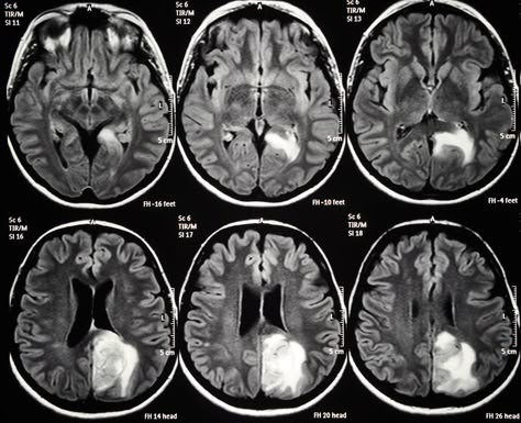 Brain Surgeon, Brain Scan, Healing Waters, Brain Surgery, John Mccain, Central Nervous System, Neurology, Radiology, Brain Health