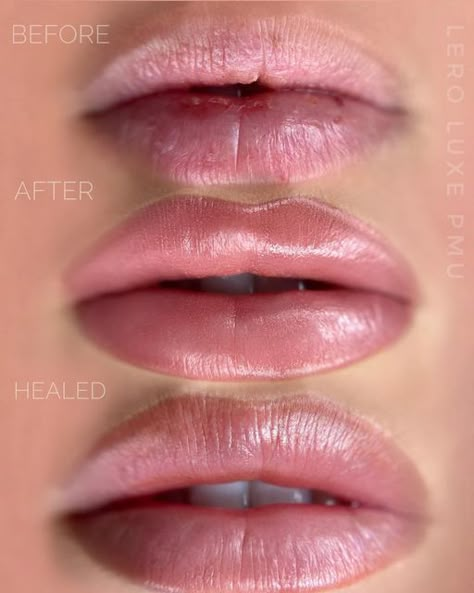 Lip Blushing Tattoo Before And After Natural, Pmu Lips Permanent Makeup, Restalyne Kysse Lips, Lip Blushing Before And After, Permanent Lip Color Tattoo, Lip Blushing Tattoo Colors, Lip Blushing Tattoo Before And After, Lip Shading, Lips Permanent Makeup