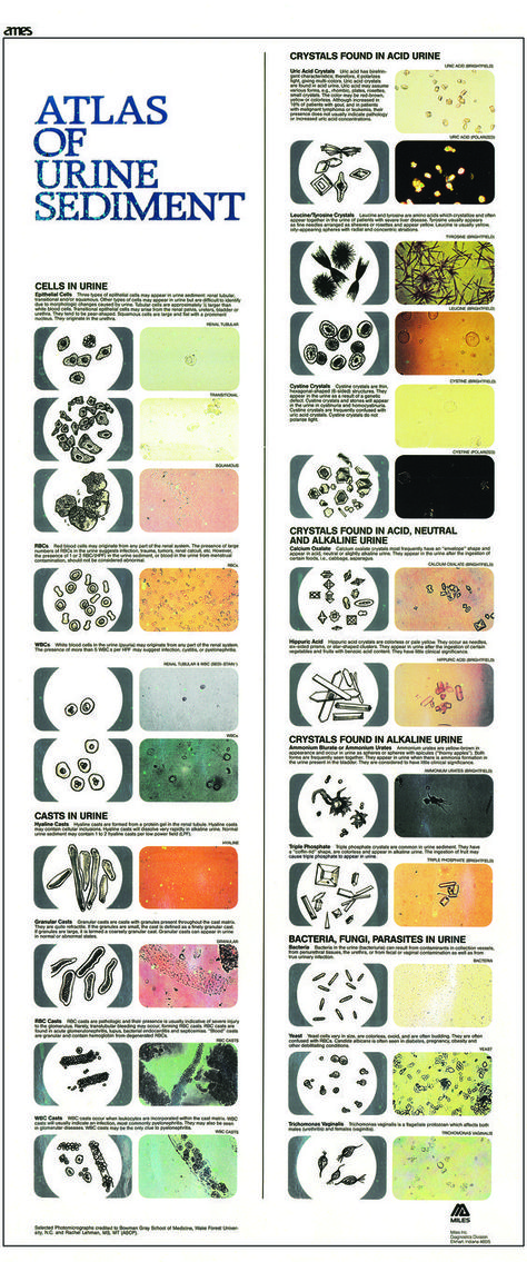 Atlas of Urine Sediment: Ear Cytology Veterinary Chart, Veterinarian Technician, Vet Tech School, Veterinary Tech, Vet Tech Student, Vet Life, Medical Laboratory Technician, Vet Technician, Medical Laboratory Scientist