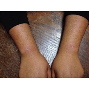 Cool Body Piercings, Dermal Piercing Wrist, Unusual Piercings, Wrist Piercing, Microdermal Piercing, Dermal Piercing, Cute Piercings, Piercings Unique, Body Piercings