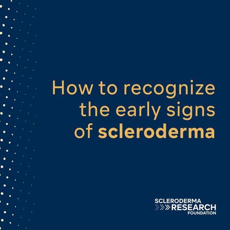 Scleroderma Research Fndn. on Instagram: "Not enough people know what scleroderma is, or how to recognize its early signs. Even though it's incredibly rare, everyone should know what to look out for. Early symptoms of scleroderma include the following: 🔹 Swollen or puffy fingers 🔹 Numbness and tingling in fingers or toes 🔹 Joint pain 🔹 Weight loss 🔹 Cold sensitivity (Raynaud’s phenomenon) Other symptoms may be present or develop later, like the following: 🔹 Shortness of breath, dizziness, Tingling In Fingers, Scleroderma Symptoms, Dry Cough, Shortness Of Breath, Chest Pain, Not Enough, Enough Is Enough, That Look, To Look