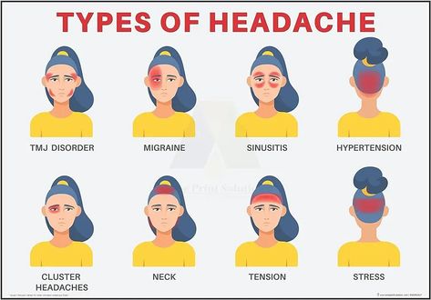 Discover the ultimate headache chart for pinpointing and managing different types of headaches. Say goodbye to pain! - #cephalalgiadiagram #cranialpainrecord #headdiscomfortvisual #headpainchart #headachechartinterpretation #headachedataanalysis #headachediary #headachedocumentation #headachejournal #headachelog #headachemap #headachepattern #headacherecording #headachesymptomrecognition #headachetracker #migrainechart #migrainegraph #naturallanguageprocessingforheadaches Types Of Headaches Chart, Headache Chart, Different Headaches, Remedy For Sinus Congestion, Home Remedies For Sinus, Forward Head Posture Exercises, Sinus Congestion Relief, Throbbing Headache, Neck And Shoulder Muscles