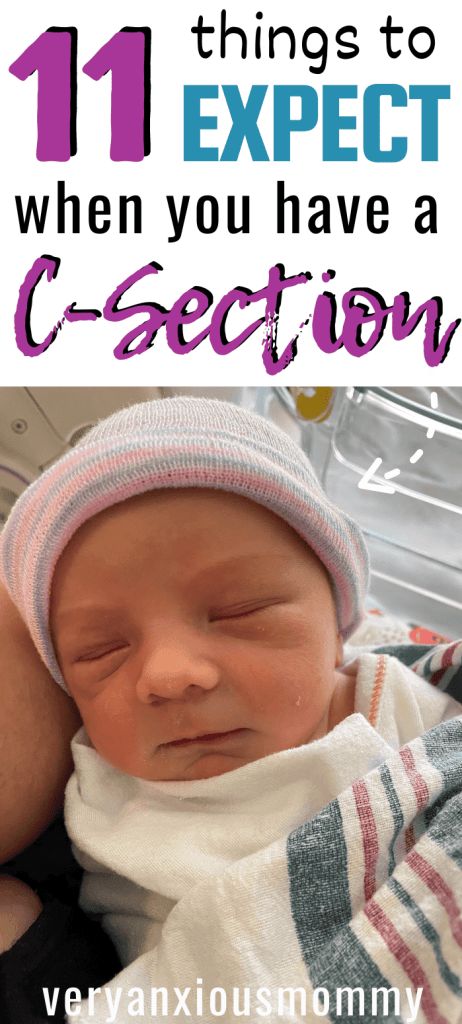 11 Secrets I Wish I Knew Before I Had My C-Section, c-section recovery, what I wish I'd known before I had a c-section, what to expect when you have a c-section, c-section birth, planned c-section, emergency c-section, scheduled c-section, csection delivery C Section Birth Plan, Prepare For C Section, Scheduled C Section, Birth Delivery, Emergency C Section, C Section Recovery, Natural Delivery, Baby Planning, Birth Labor