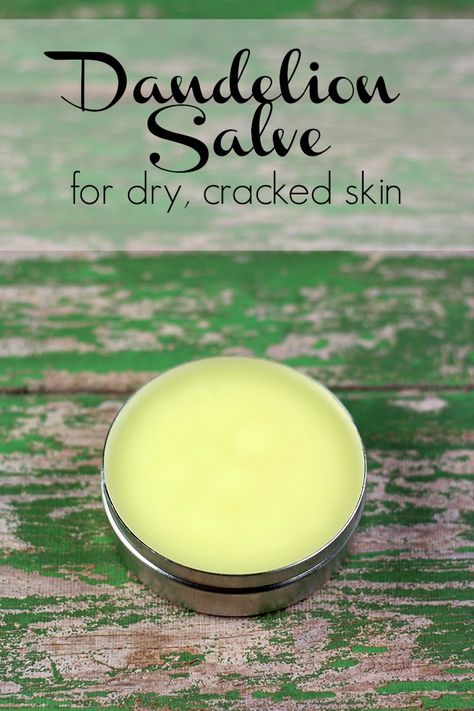 Dandelion Salve Recipes, Homemade Salve Recipes, Diy Dandelion, Dandelion Salve, Homemade Salve, Yard Diy, Coconut Oil For Acne, Salve Recipes, Homemade Moisturizer