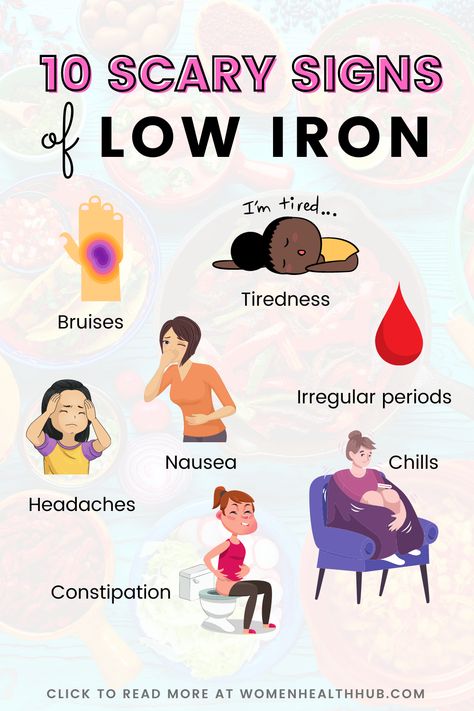 Don't dismiss these weird symptoms of low iron anemia. Watch out for these signs of iron deficiency and get them treated ASAP. Period Nausea, Iron Deficiency Symptoms, Signs Of Iron Deficiency, Signs Of Magnesium Deficiency, Low Estrogen Symptoms, Too Much Estrogen, Tongue Health, Iron Deficiency, Migraine Headaches