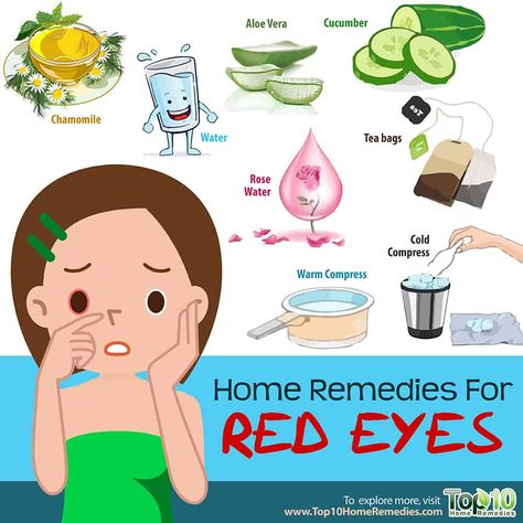 home remedies for red eyes Eye Redness Remedies, How To Get Rid Of Red Eyes, Eye Infection Remedies, Red Eyes Remedy, What Causes Red Eyes, Straight Curls, Pinkeye Remedies, Cold Eye Mask, Bloodshot Eyes