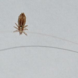 Lice - Lice Pictures: Adult Head Louse - Magnified Head Lice Picture Lice Pictures, Lice Facts, Lice Nits, Lice Remedies, Lice Shampoo, Termite Prevention, Hair Lice, Lice Prevention, Lice Eggs