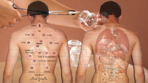 5 Benefits Of Cupping Therapy For Your Back | Top Natural Remedy What Is Cupping Therapy, Cupping Points, Body Cupping, Wet Cupping, Benefits Of Cupping, Hijama Cupping, Fire Cupping, Cupping Massage, Relax Muscles