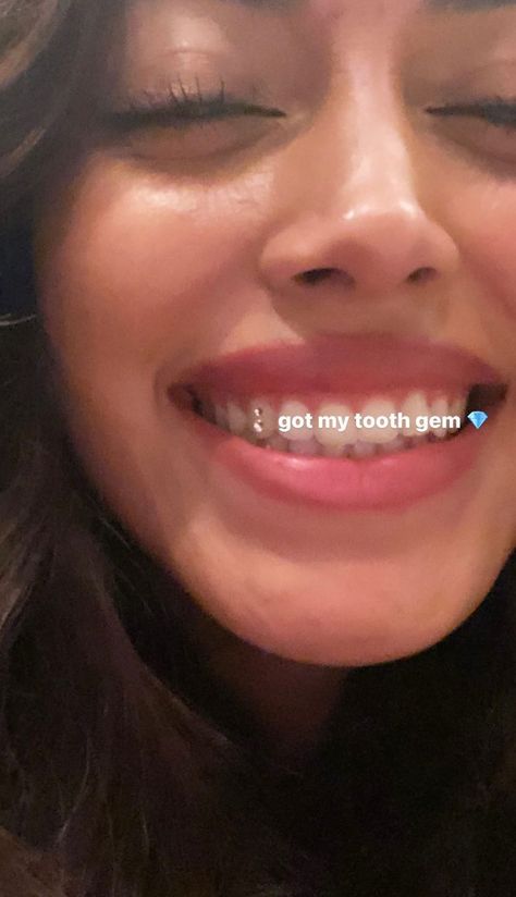 White Teeth Aesthetic, Crest Teeth Whitening Strips, Pretty Teeth, Diamond Teeth, Whitening Strips, Perfect Teeth, Teeth Whitening Strips, Smile Teeth, Tooth Gem