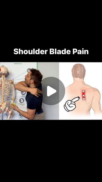 James The Osteopath on Instagram: "Here is how to get rid of shoulder blade pain. #ShoulderBladePain #BackPain #rhomboidpain" Knots In Shoulder Blade, Shoulder Blade Stretches For Pain, Pain Between Shoulder Blades, Shoulder Blade Stretch, Reverse Shoulder Replacement, Shoulder Blade Pain, Shoulder Stretches, Shoulder Knots, Shoulder Muscles