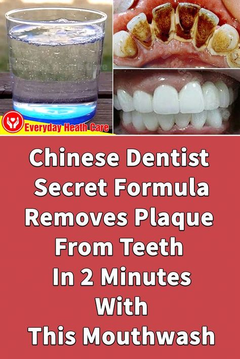 This Mouthwash Removes Plaque From Teeth In 2 Minutes Heath Care, Kids Teeth, Dental Plaque, Whiten Teeth, Plaque Removal, Dental Cleaning, Receding Gums, Everyday Health, Healthy Smile