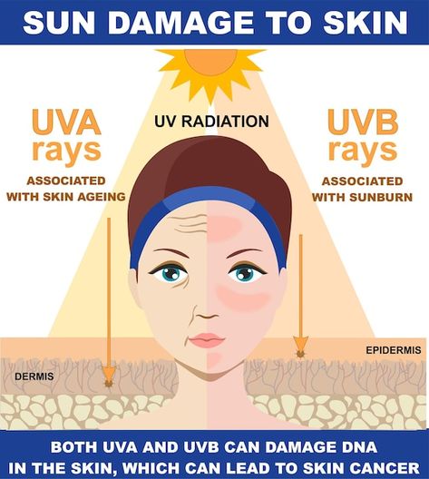 Sun damage to skin, infographic of diffe... | Premium Vector #Freepik #vector #uv-rays #sun-burn #skin-burn #uv-light Skin Infographic, How To Tan, Sun Lamp, Sun Burn, Plant Lighting, Sun Damage, Sun Care, Sun Rays, Damaged Skin