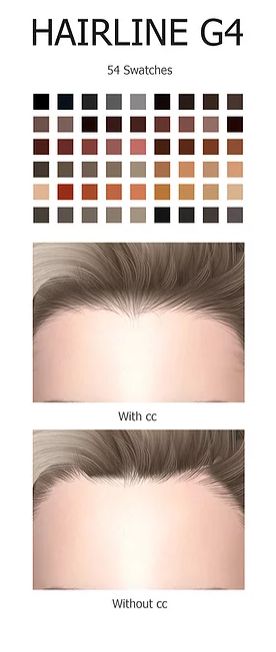 Click the picture to download. Ts4 Hairline, Sims 4 Cc Hairline, Sims 4 Hairline Cc, Sims 4 Hairline, Sims Collection, Eaten Alive, Free Sims 4, Skin Details, Sims 4 Game Mods