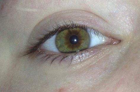 central heterochromia with green and brown, eyes Green And Brown Heterochromia Eyes, Brown And Green Heterochromia, Heterochromia Eyes Brown And Green, Central Heterochromia Eyes Green Brown, Hetorcromia Eyes, Scp Oc, Central Heterochromia, Nature Reference, Youtuber Dr