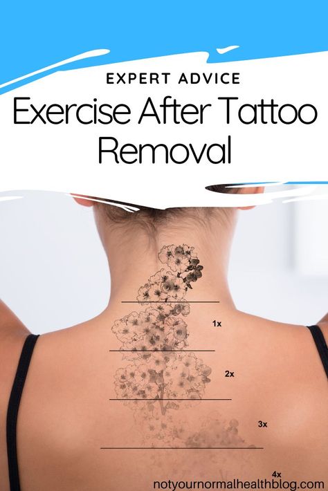 If you're having a tattoo removed you want the process to go as smoothly, and quickly, as possible and taking a break from your normal workouts is a part of that - but why is this - and how long do you need to take a break for? We asked an expert laser surgeon for their advice. After Tattoo, Laser Tattoo Removal, Best Spa, Taking A Break, Too Soon, Healthy Beauty, Tattoo Removal, But Why, Take A Break