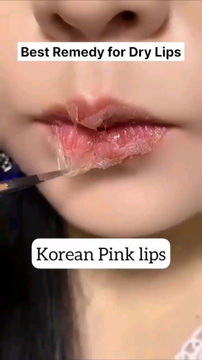 💋Get Pink & Soft Lips Naturally At Home/Get Rid of Dark & Dry Lips😍 #shorts#lips#youtubeshorts#viral Dry Lips Remedy, For Pink Lips, Remedies For Dark Lips, Soft Pink Lips, Natural Pink Lips, Dry Lip, Lip Care Tips, Lip Tips, Korean Lips