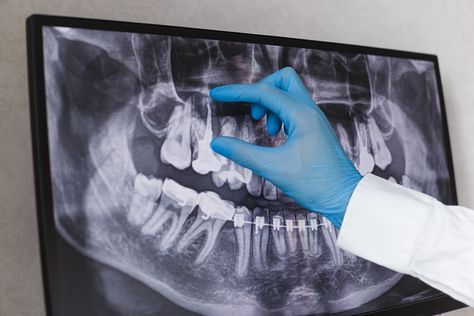 Here’s a link to an article from which is a website that provides a mass amount of collections for hygienists including articles for specific topics (like radiology), podcasts, CE courses, etc.  Sources used in the articles come from studies/resources pubmed, ncbi, CDCA, and other accredited sources.  The articles are written by a set group of hygienists and hygienists who regularly contribute as writers; they gather information/studies to inform and update on new regulations and standards Holistic Dentistry, Dental Fillings, Dental Surgeon, Wisdom Teeth Removal, Oral Surgeon, Tooth Removal, Restorative Dentistry, Tooth Pain, Family Dental