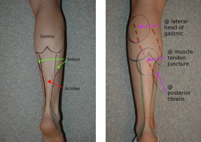 Calf Anatomy, Athletes Training, Achilles Tendinopathy, Achilles Pain, Psoas Release, Calf Pain, Foot Exercises, Achilles Tendon, Leg Cramps