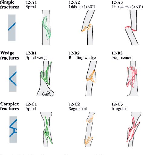 Humerus Fracture, Humerus Bone, Radiology Student, Bone Fracture, Radiology, Open Book, Physical Therapy, Fig, Nursing