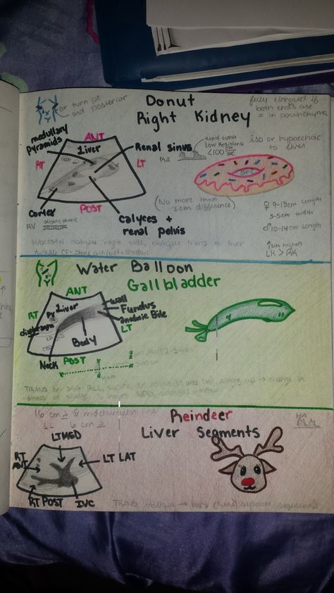 Ultrasound sketches Ultrasound Technician Notes, Ultrasound Notes Study, Ultrasound Tech Notes, Cardiovascular Sonography Aesthetic, Ultrasound Tech Graduation Pictures, Sonography Notes, Ultrasound Technician Student, Ob Sonography, Sonography Student Study