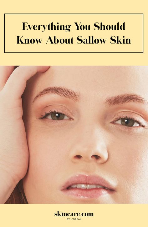 How to Treat and Prevent Sallow Skin Yellow Undertone Skin, Sallow Skin, Bright Glowing Skin, Simple Beauty Tips, Skincare Advice, Vitamin Deficiency, Healthy Scalp, Skin Skincare, Hair Problems