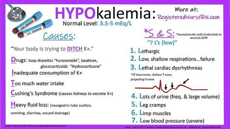 Nurse Sarah on Instagram: “HYPOkalemia Mnemonics for Causes & Signs/Symptoms ⭐This is a quick review to help summarize the causes and signs/symptoms of HYPOkalemia.…” Nursing Terminology, Electrolytes Nursing, Lpn School, Nclex Notes, Med Surge, Nursing Planner, Nurse Essentials, Nursing Labs, Nursing Flashcards