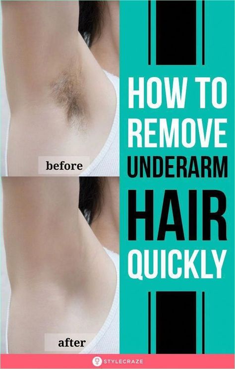 Vegetable egg cups are nutritious and delicious fo Hair Removal Lotion, How To Remove Unwanted Hair Permanently, How To Remove Underarm Hair, Remove Underarm Hair, Upper Lip Hair Removal, Hair Remove, Upper Lip Hair, Calorie Workout, Unwanted Hair Permanently