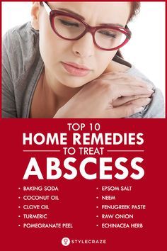 Top 10 Home Remedies To Treat Abscess Natural Headache, Remedies For Tooth Ache, Top 10 Home Remedies, Natural Headache Remedies, Allergy Remedies, Ginger Benefits, Natural Healing Remedies, Natural Sleep Remedies, Natural Cold Remedies